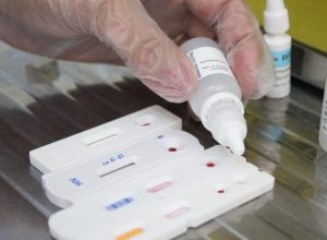 Testes-hepatites-virais-2-Foto-de-Fabio-Guimaraes-1